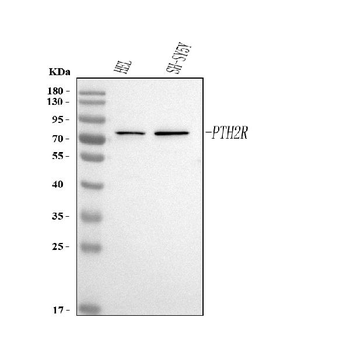 PTH2R Rabbit Polyclonal Antibody