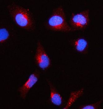ACAT1 Rabbit Polyclonal Antibody
