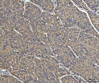 ACAT1 Rabbit Polyclonal Antibody
