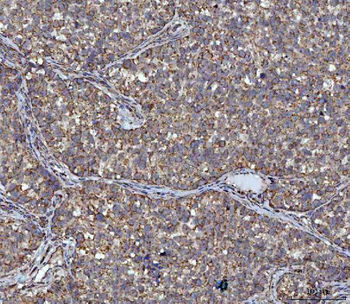 ACAT1 Rabbit Polyclonal Antibody