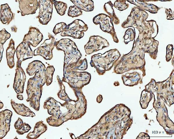 ACAT1 Rabbit Polyclonal Antibody