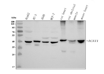 ACAT1 Rabbit Polyclonal Antibody