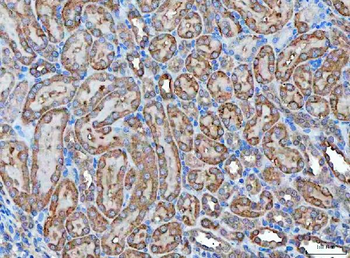 Klk7 Rabbit Polyclonal Antibody