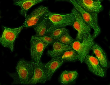 GLI2 Rabbit Polyclonal Antibody