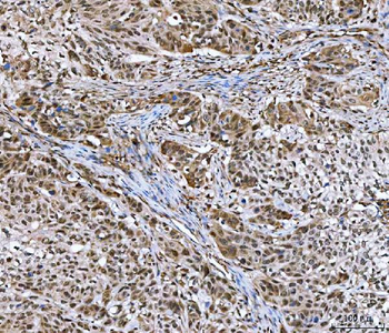 GLI2 Rabbit Polyclonal Antibody