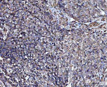 PRMT7 Rabbit Polyclonal Antibody