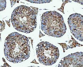 PRMT7 Rabbit Polyclonal Antibody