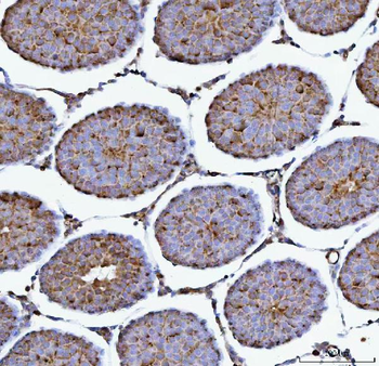 PRMT7 Rabbit Polyclonal Antibody