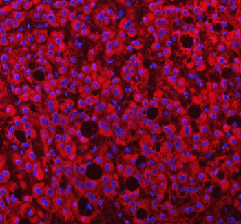 PAPSS2 Rabbit Polyclonal Antibody