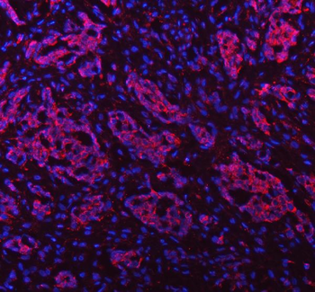 PAPSS2 Rabbit Polyclonal Antibody