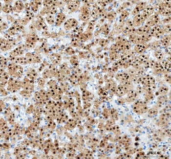 PAPSS2 Rabbit Polyclonal Antibody