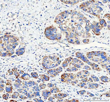 PAPSS2 Rabbit Polyclonal Antibody