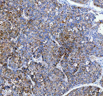 PAPSS2 Rabbit Polyclonal Antibody