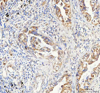 PAPSS2 Rabbit Polyclonal Antibody