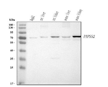 PAPSS2 Rabbit Polyclonal Antibody