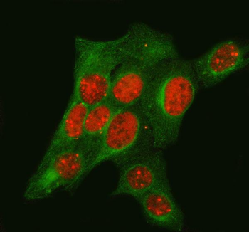 TP53BP1 Rabbit Polyclonal Antibody