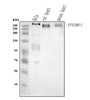 TP53BP1 Rabbit Polyclonal Antibody