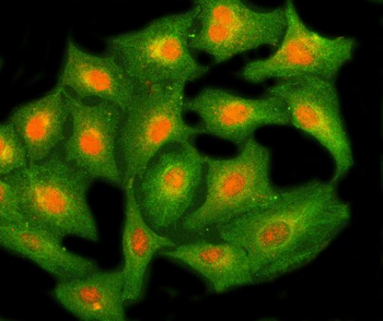 NHP2 Rabbit Polyclonal Antibody