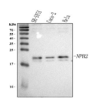 NHP2 Rabbit Polyclonal Antibody