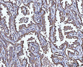 CCL15 Rabbit Polyclonal Antibody
