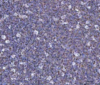 CCL15 Rabbit Polyclonal Antibody