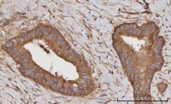CCL23 Rabbit Polyclonal Antibody