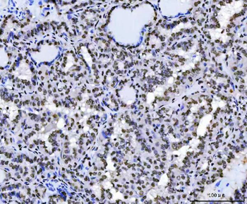 Sam68/KHDRBS1 Rabbit Polyclonal Antibody