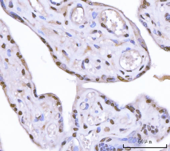 Sam68/KHDRBS1 Rabbit Polyclonal Antibody