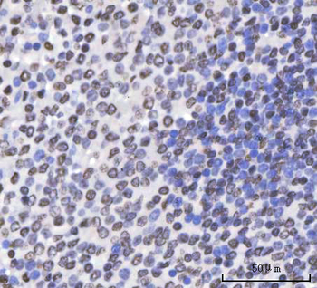 Sam68/KHDRBS1 Rabbit Polyclonal Antibody