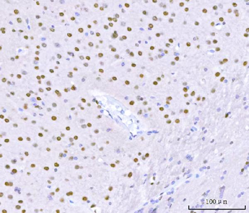 Sam68/KHDRBS1 Rabbit Polyclonal Antibody