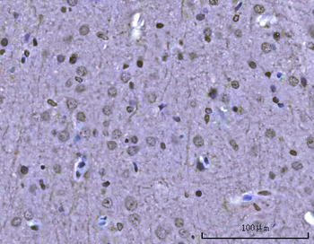 Sam68/KHDRBS1 Rabbit Polyclonal Antibody