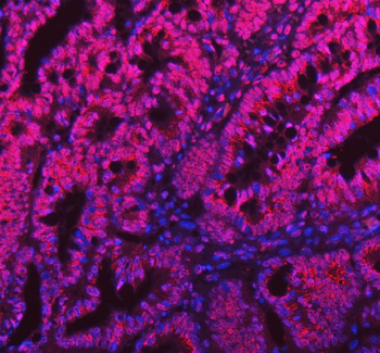 Sam68/KHDRBS1 Rabbit Polyclonal Antibody