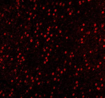 Sam68/KHDRBS1 Rabbit Polyclonal Antibody