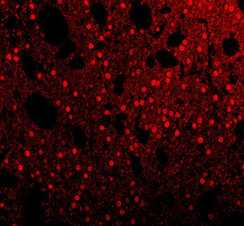 Sam68/KHDRBS1 Rabbit Polyclonal Antibody