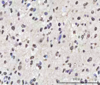Sam68/KHDRBS1 Rabbit Polyclonal Antibody