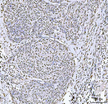 Sam68/KHDRBS1 Rabbit Polyclonal Antibody