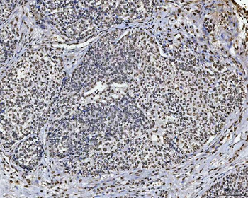 Sam68/KHDRBS1 Rabbit Polyclonal Antibody