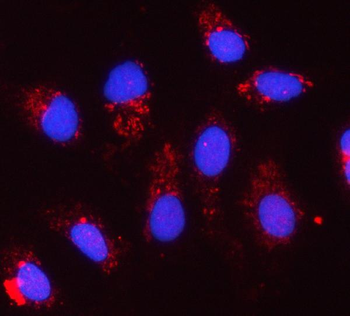CYC1 Rabbit Polyclonal Antibody