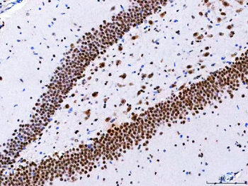 NCBP1 Rabbit Polyclonal Antibody