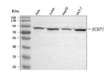 NCBP1 Rabbit Polyclonal Antibody