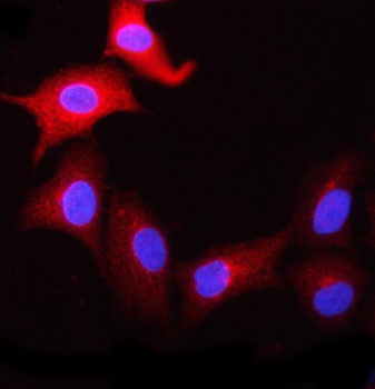 NCBP1 Rabbit Polyclonal Antibody