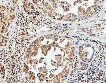 NCBP1 Rabbit Polyclonal Antibody
