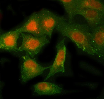 NBR1 Rabbit Polyclonal Antibody