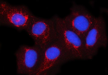 NDUFA4 Rabbit Polyclonal Antibody