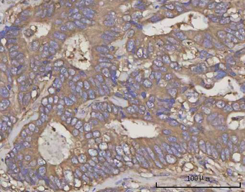 NDUFA4 Rabbit Polyclonal Antibody