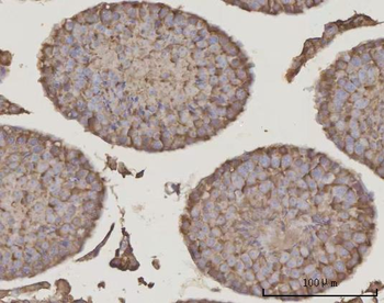 PRDM2 Rabbit Polyclonal Antibody