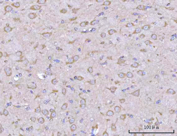 PPFIA2 Rabbit Polyclonal Antibody