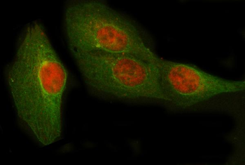 POLR2D Rabbit Polyclonal Antibody