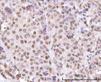 SF3A2 Rabbit Polyclonal Antibody