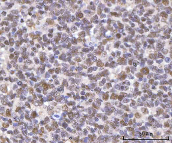 SF3A2 Rabbit Polyclonal Antibody